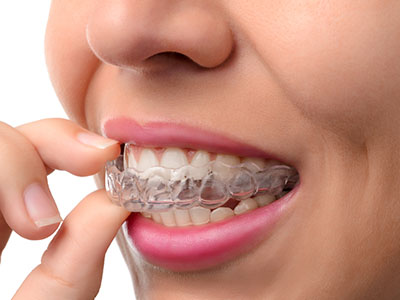 Bright Smile Dental Care, LTD | Periodontal Treatment, Dental Sealants and CEREC
