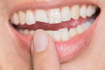 Bright Smile Dental Care, LTD | Implant Dentistry, Dental Fillings and Cosmetic Dentistry