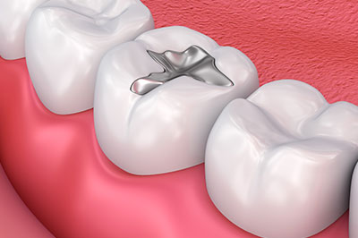 Bright Smile Dental Care, LTD | Cosmetic Dentistry, Periodontal Treatment and Botox reg 