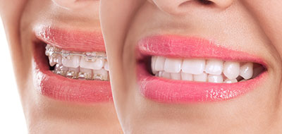 Bright Smile Dental Care, LTD | TMJ Disorders, Sleep Apnea and Night Guards