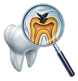 Bright Smile Dental Care, LTD | Preventative Program, Ceramic Crowns and Orthodontics