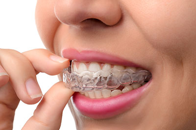 Bright Smile Dental Care, LTD | Dentures, Night Guards and Oral Exams