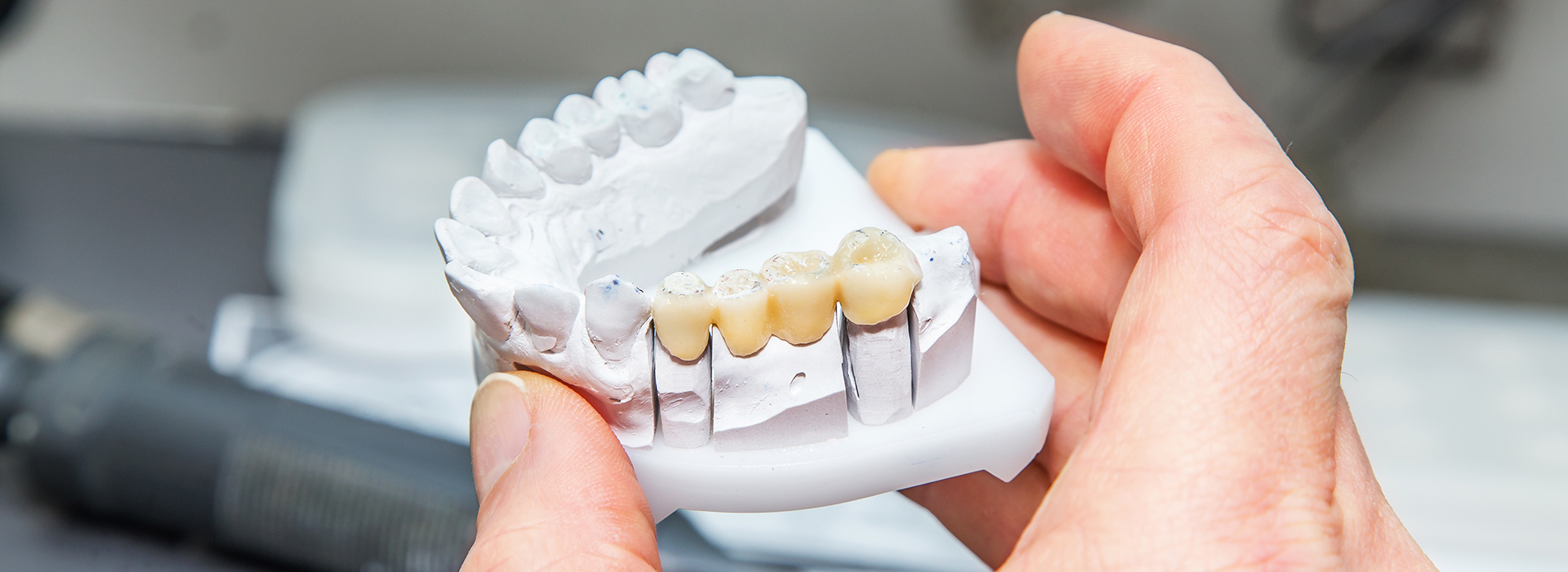Bright Smile Dental Care, LTD | Extractions, Pediatric Dentistry and Preventative Program